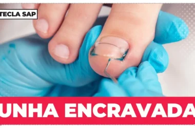Como se diz unha encravada em inglês? Aprenda agora
